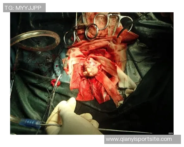 埃奇库姆小腿恢复良好场均144分展现出色状态